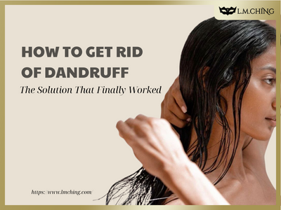 [NEW] How to Get Rid of Dandruff: The Solution That Finally Worked