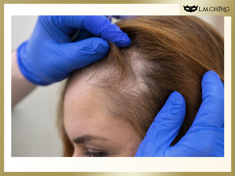 Hair Growth Serum