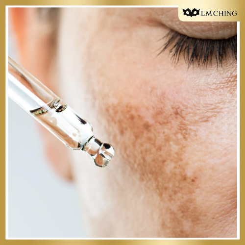 How SkinCeuticals C E Ferulic Helps Reduce Hyperpigmentation and Dark Spots