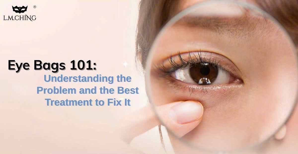 Eye Bags 101: Understanding the Problem and the Best Treatment to Fix It