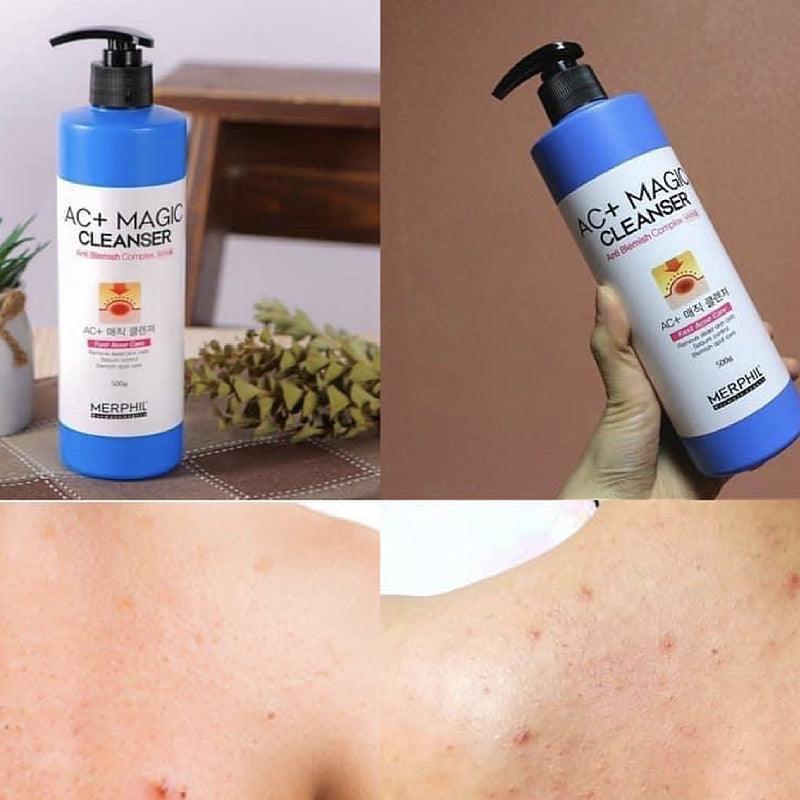 MERPHIL AC+ Magic Centella Acne & Pore Body Wash Cleanser 500g