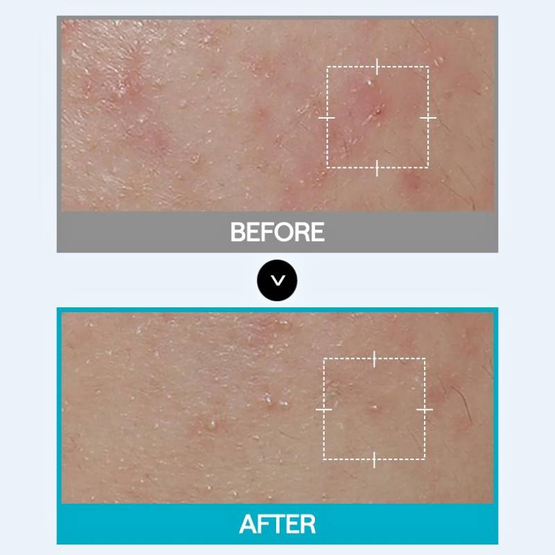 MEDIHEAL Madecassoside Wrapping Serum Mask 25ml x 10