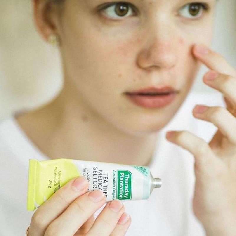 Thursday Plantation Gel Chấm Mụn Tràm Trà Tea Tree Medicated Gel For Acne 25g