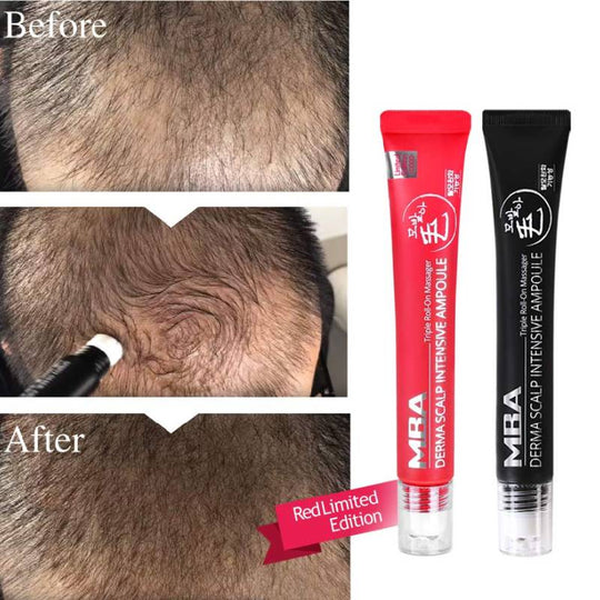 DAYCELL MBA MoBalA Derma Scalp Intensive Serum 20ml