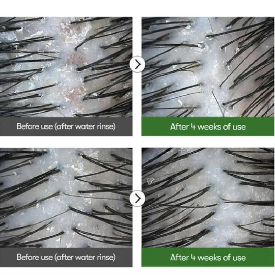 VT Cosmetics PDRN Reedle Shot Hair Ampoule 100dL 15ml