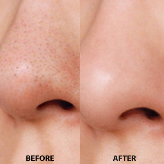 COGIT Keratotic Plug Smooth Soap (Moisture) 8g