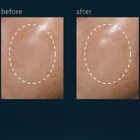 cle de peau BEAUTE Hydro-Clarifying Essence Lotion 170ml