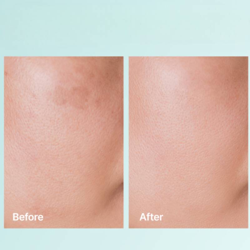 REJURAN Turnover Cream Enhanced c-PDRN 0.2% 50ml