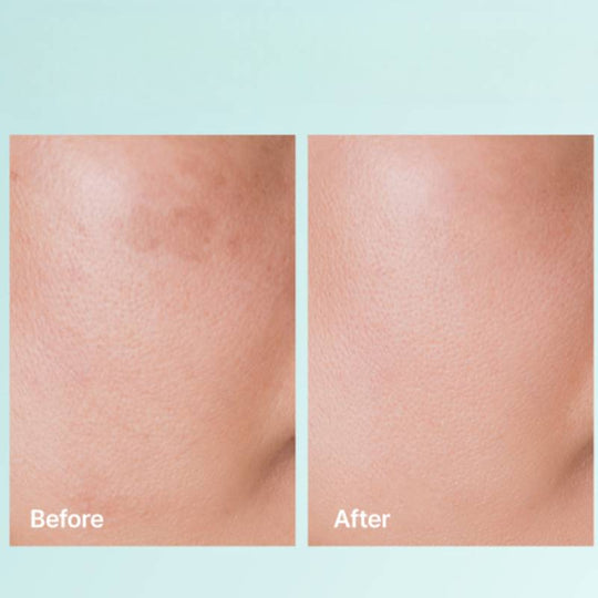 REJURAN Turnover Cream Enhanced c-PDRN 0.2% 50ml