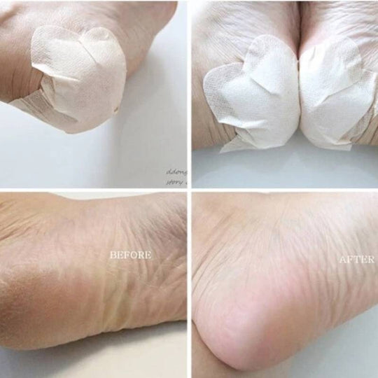 RiRe Heel Care Foot Patch 10pc