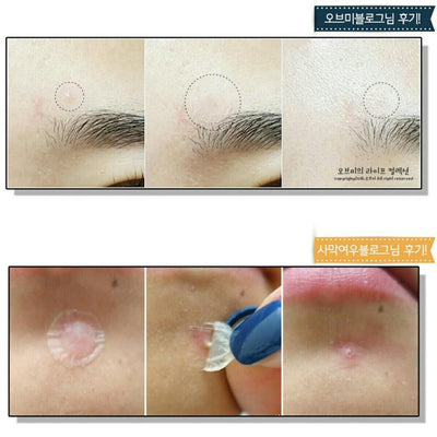 Dr+ Wonder Anti Spot Acne & Pimple Removing Sticker Patch (Green Box-Invisiable Version) 60pcs/box - LMCHING Group Limited