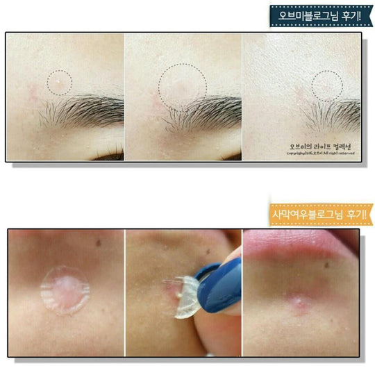 Dr+ Wonder Anti Spot Acne & Pimple Removing Sticker Patch (Green Box-Invisiable Version) 60pcs/box - LMCHING Group Limited