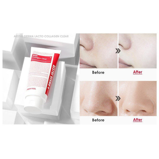 MEDIPEEL Aesthe Derma Lacto Collagen Clear Cleansing Foam 300ml - LMCHING Group Limited