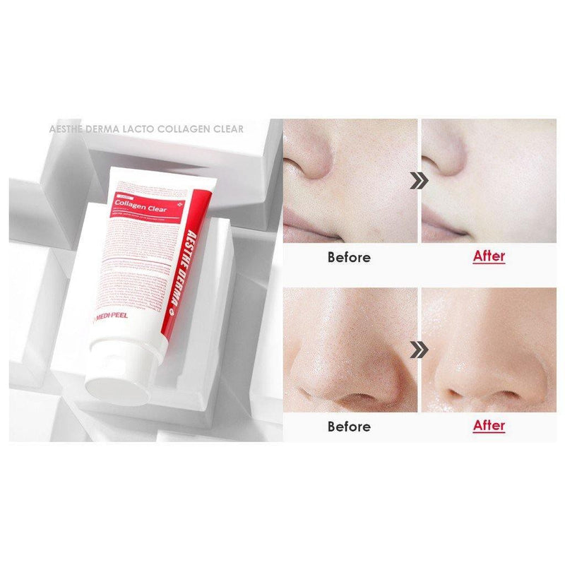 MEDIPEEL Aesthe Derma Lacto Collagen Clear Cleansing Foam 300ml - LMCHING Group Limited