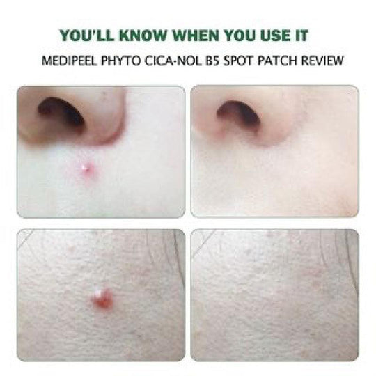 MEDIPEEL Phyto Cica-Nol B5 Spot Patch 12pcs/pack - LMCHING Group Limited