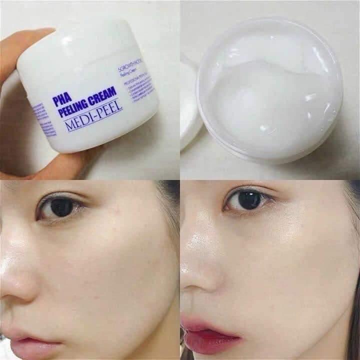 MEDIPEEL Premium PHA Instant Peeling Cream 50ml - LMCHING Group Limited