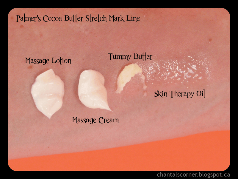 PALMER'S COCOA BUTTER FORMULA for Dry & Itchy Skin (Soothing Oil) 150ml - LMCHING Group Limited
