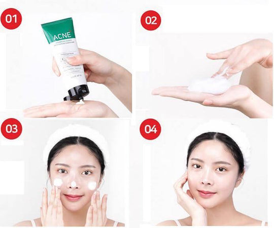Some By Mi 30 Days Miracle Acne Cleansing Foam (AHA, BHA & PHA) 100ml - LMCHING Group Limited