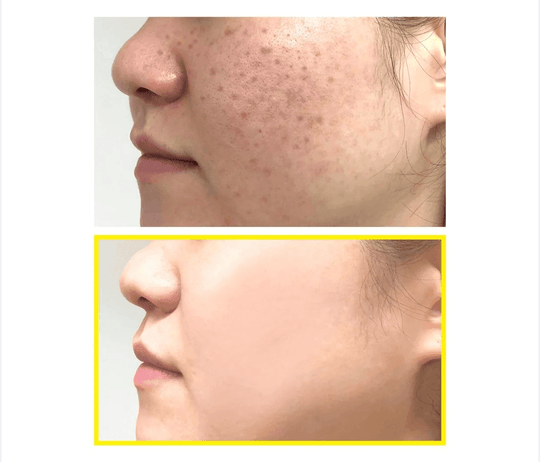Some By Mi Yuja Niacin Blemish Care Serum Mask 5pcs - LMCHING Group Limited