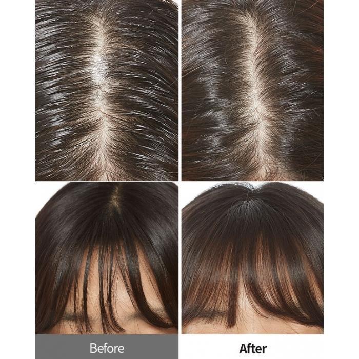 APIEU Oily Hair Dry Powder 5g - LMCHING Group Limited